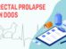 Rectal Prolapse In Dogs