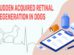 Sudden Acquired Retinal Degeneration In Dogs