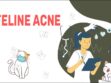 Feline Acne