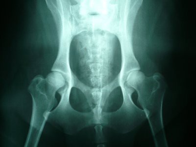 english-springer-hip-dysplasia