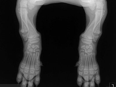 chondrodysplasia