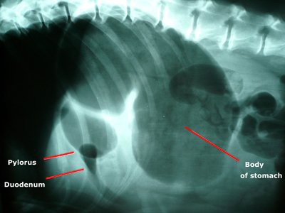 Bloating Symptoms and Treatment