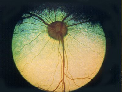 progressive-retinal-atrophy